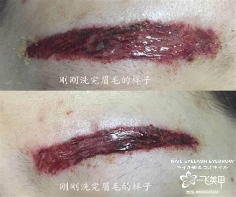 紋眉一點(diǎn)要慎重，別貪便宜，不然就是文中后果