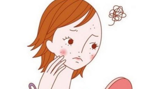痘痘的病因有哪些？為什么會長痘？