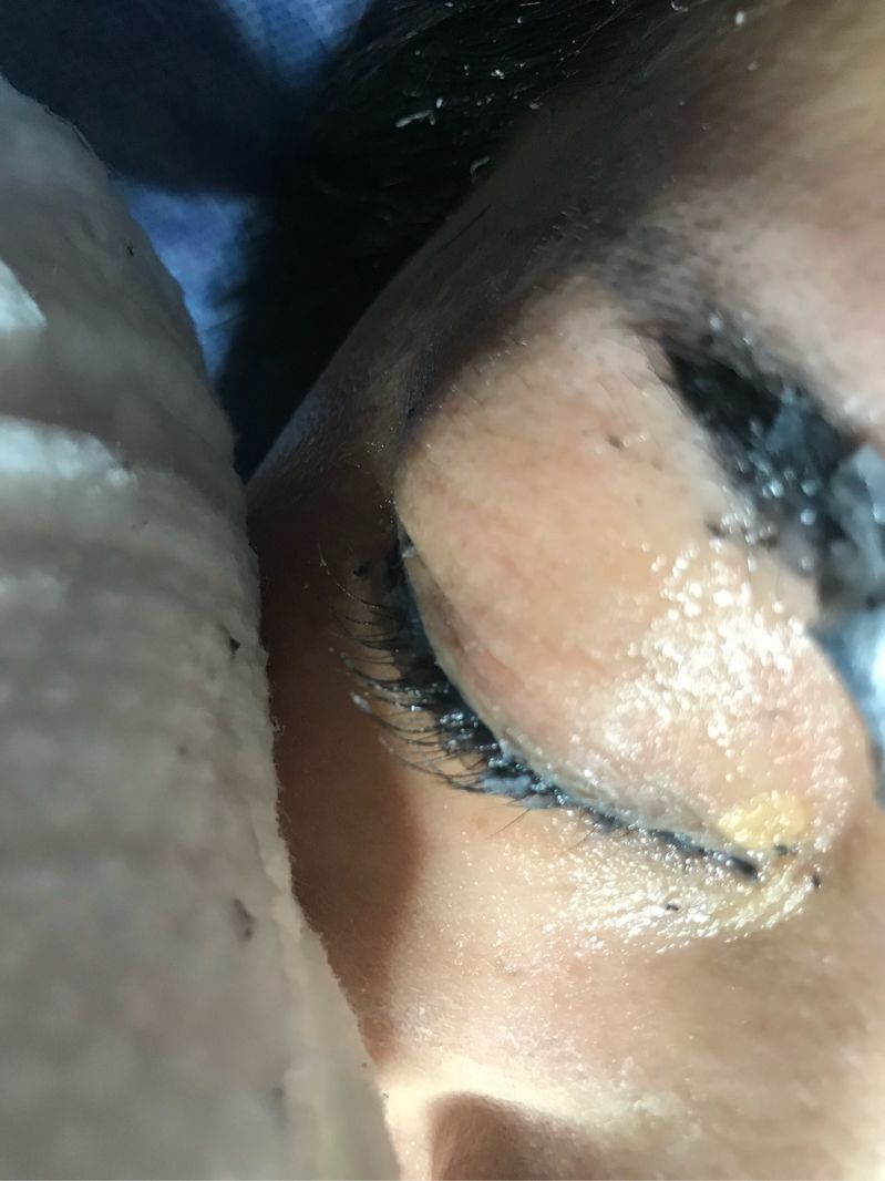 車禍現(xiàn)場，引以為戒！