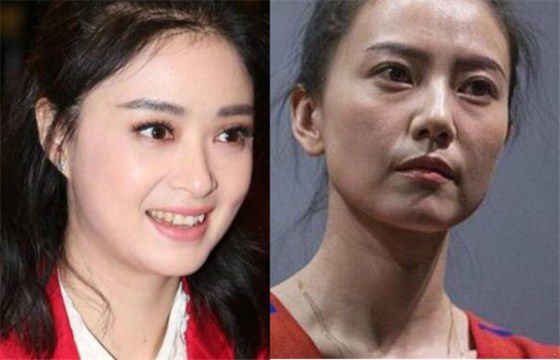 曾經(jīng)的甜心教主王心凌臉垮成這樣了，真替這5位女星捏把汗啊