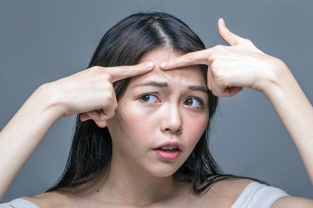 閉口怎么去除小妙招，告訴你簡單的去除技巧