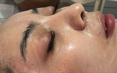 蜂蜜涂在臉上去斑嗎