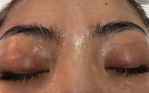 魚尾紋在臉上哪個部位