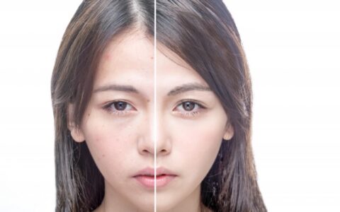 怎么清除痘痘，有效調(diào)理痘痘肌的方法