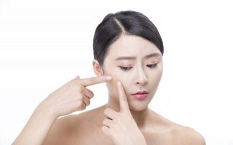 痘痘皮膚如何護理，痘肌護理指南
