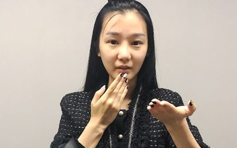 面部皮膚松弛小妙招 解決皮膚松弛問題